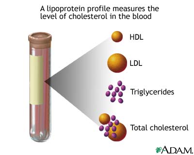 cholesterol testing