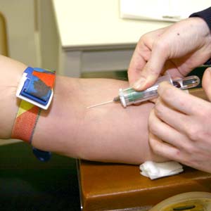cholesterol testing