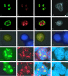 plc prf 5 cells