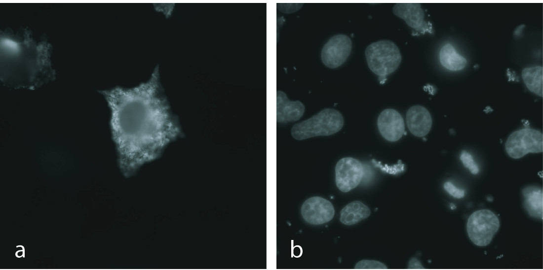 plc prf 5 cells