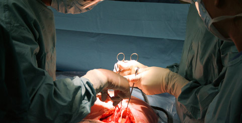 vision correction surgery