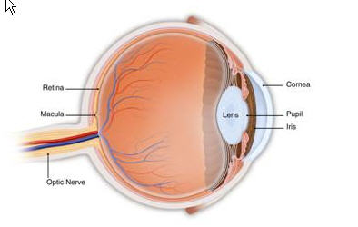 refractive surgery