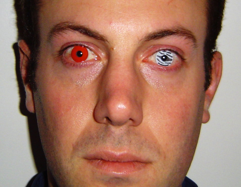 contact lenses