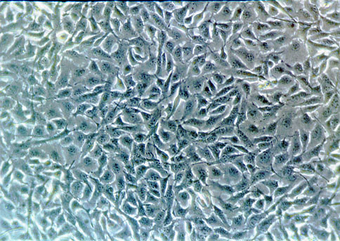 b16 melanoma