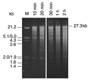 tbe gel electrophoresis
