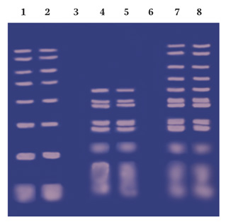 agarose tbe