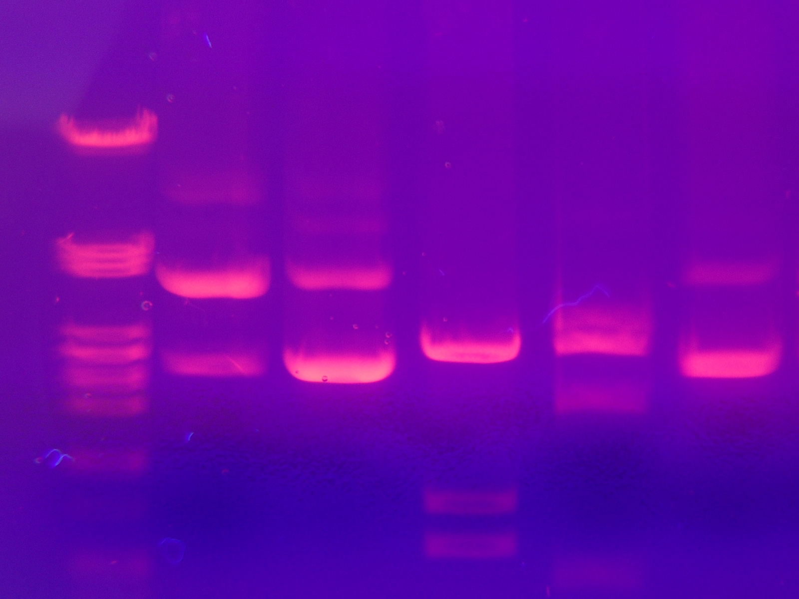 tbe gel electrophoresis