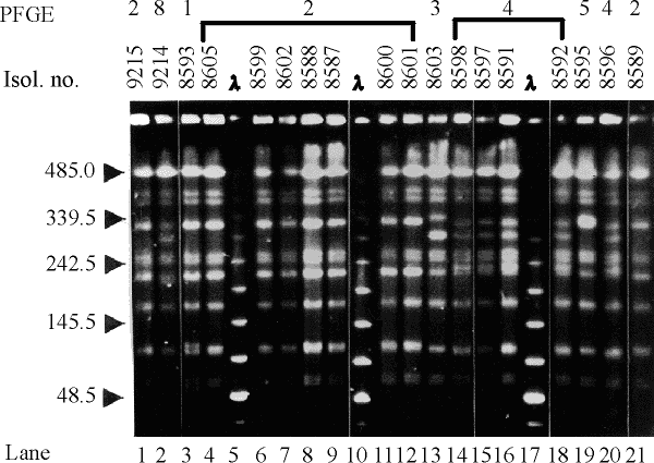 tbe electrophoresis