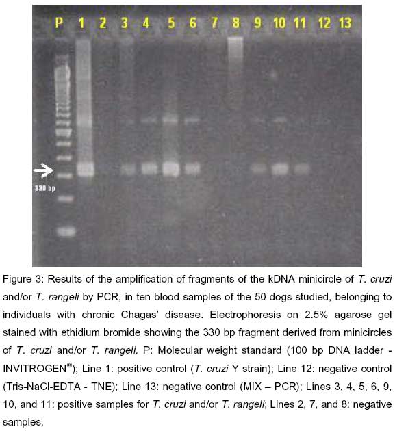 tbe gel electrophoresis