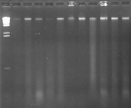 tbe protocol