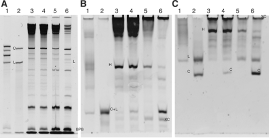 tbe electrophoresis