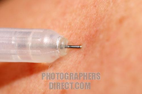 tbe vaccination
