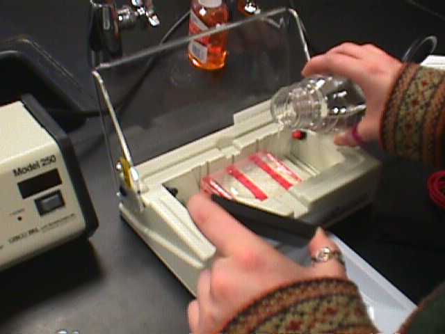 tbe electrophoresis