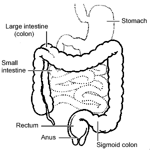 ibd inflammation