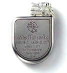 icd pacemaker