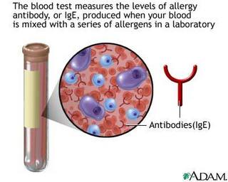 igd antibodies