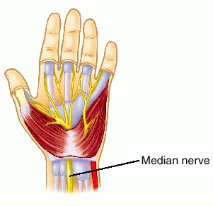 igd syndrome