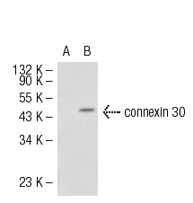 connexin 30
